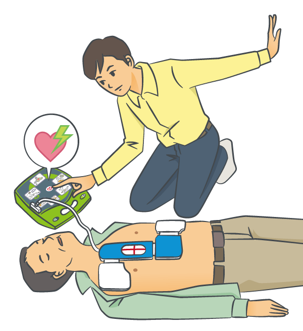 AED(電気ショック)