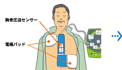 一体型の除細動パッド