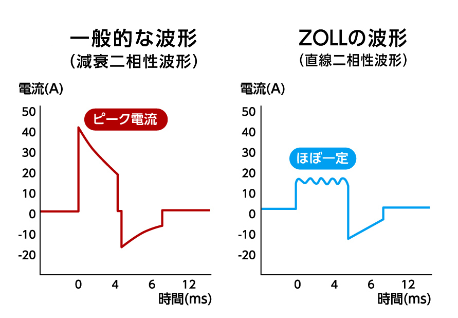 傷病者に合わせた負担の少ない直線二相性波形(RBW)の除細動