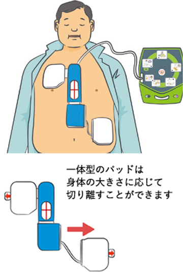 体が大きい傷病者の場合