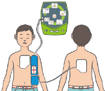 やむを得ず、未就学児に使う場合