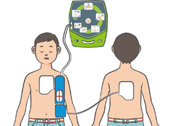 やむを得ず、未就学児に使う場合