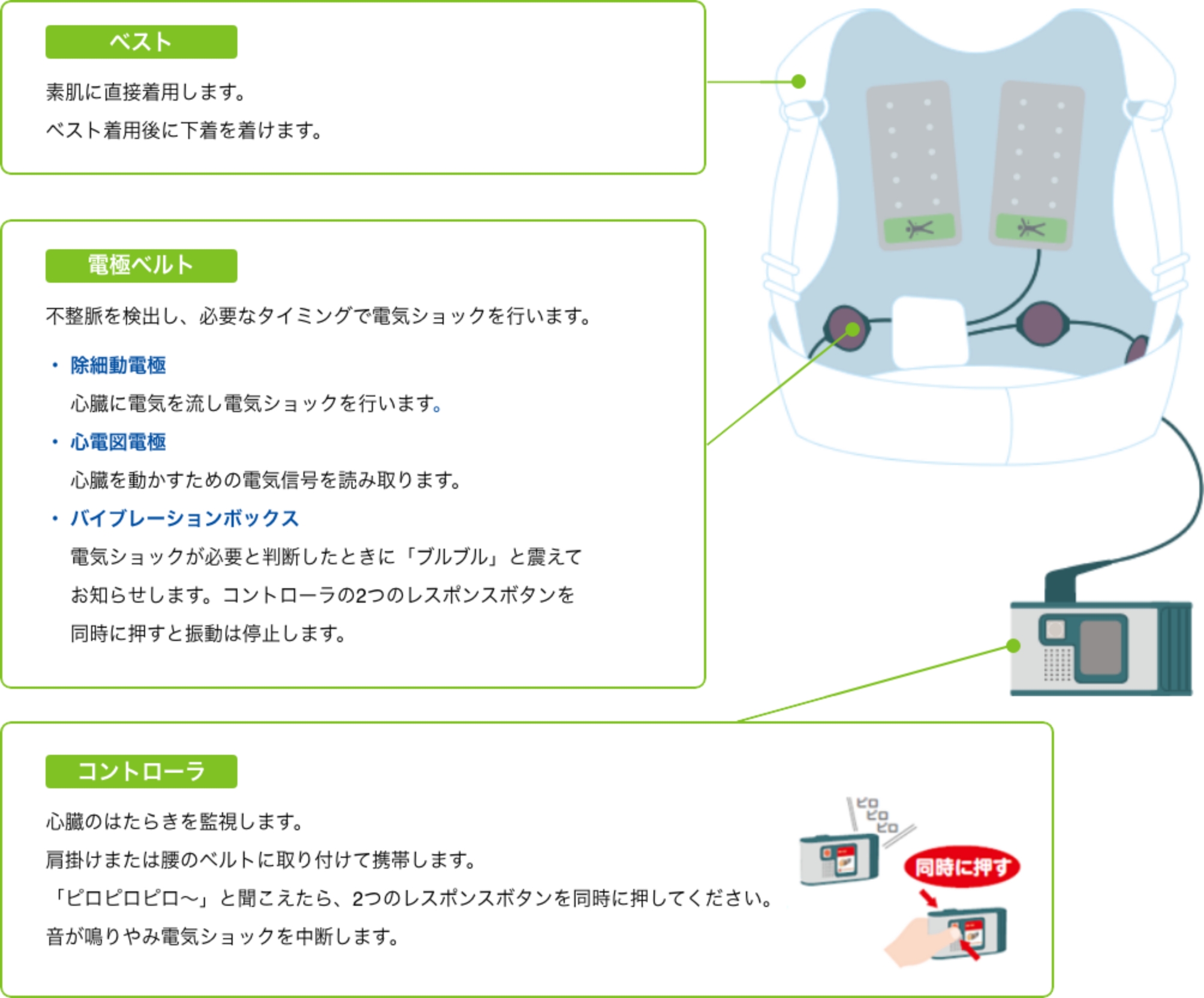 WCDの構成