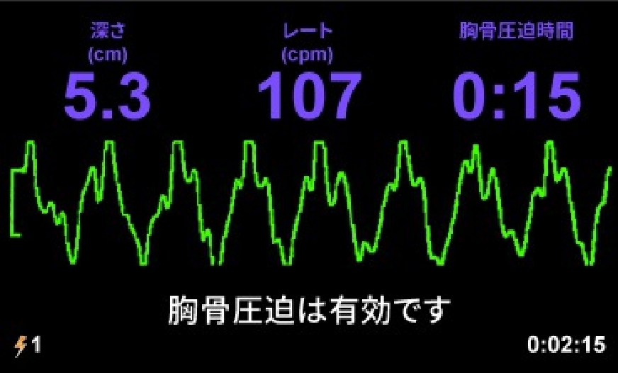 Ｅｘｃｅｌによる生体信号解析 心電図・脈波・血圧/エヌ・ティ-・エス/三宅晋司（単行本） Excelによる生体信号解析 ―心電図、脈波、血圧 | 三宅 晋司 |本