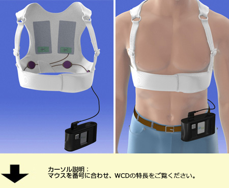 製品情報｜着用型自動除細動器 LifeVest｜旭化成ゾール
