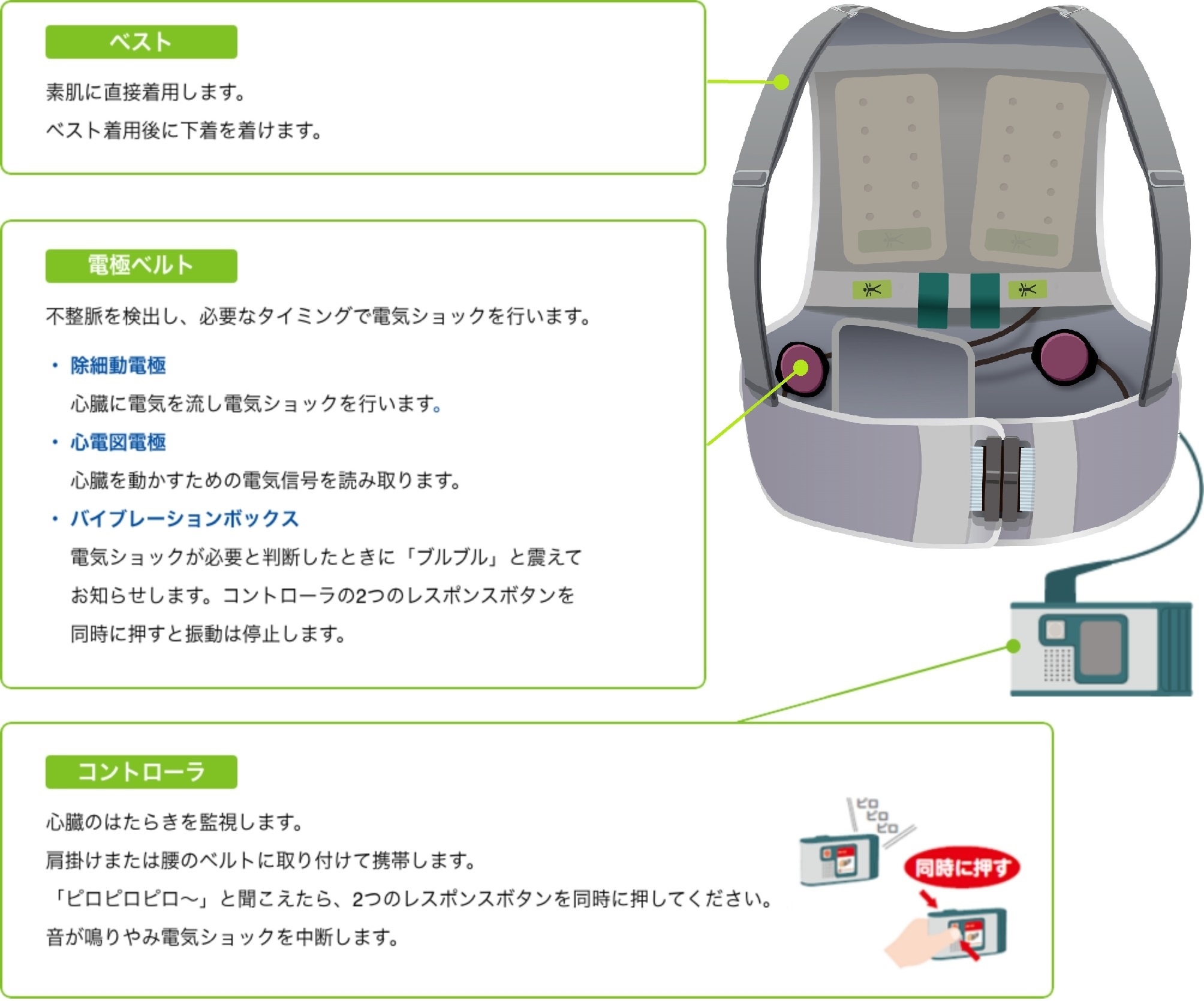 WCDの構成