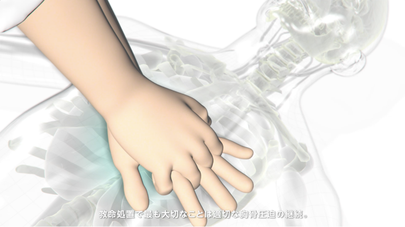 AutoPulse｜旭化成ゾールメディカル｜AEDをはじめとした救急医療製品の販売