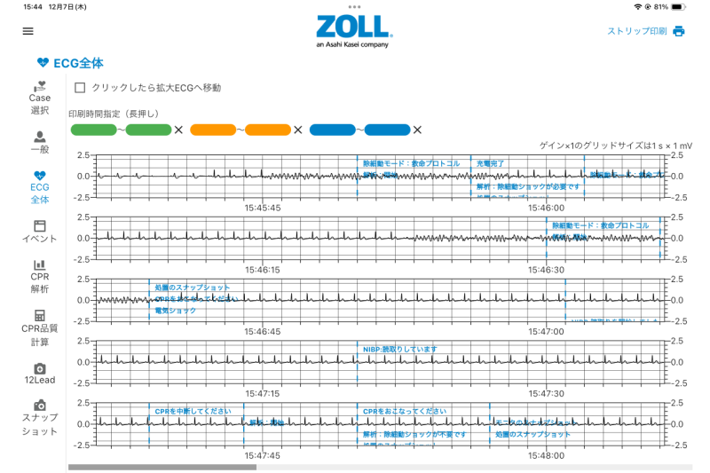 CodeMate™|旭化成ゾールメディカル|AEDをはじめとした救急医療 CodeMate™|旭化成ゾールメディカル|AEDをはじめとした救急医療